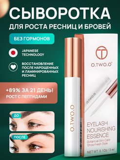 Отзыв на 