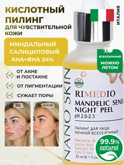 Отзыв на 