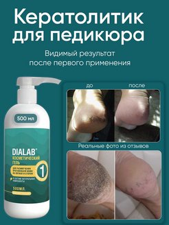 Отзыв на 