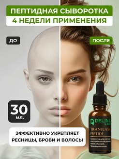 Отзыв на 