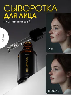Скидка на Сыворотка для лица от прыщей и акне